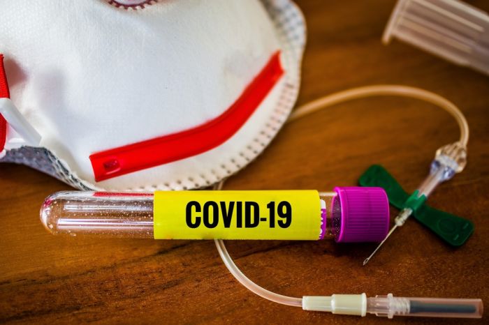 Росздравнадзор запретил применение экспресс-тестов на COVID-19 в домашних условиях