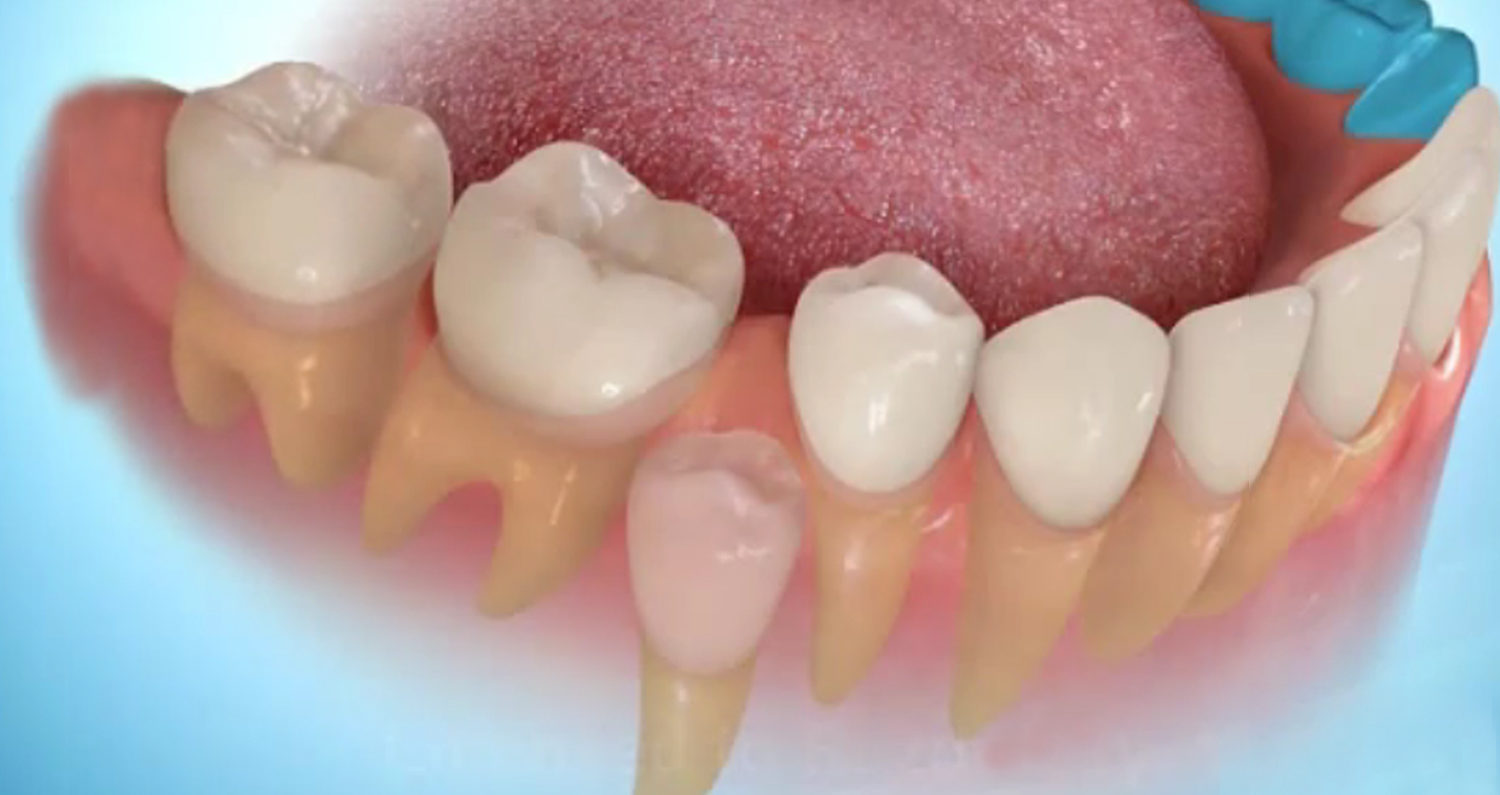Ученые поняли, каким образом, влияя на гены, вырастить новые зубы